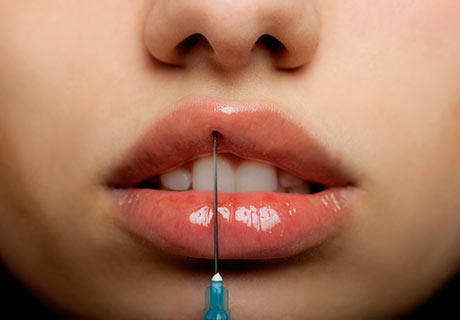 aumento de labios cirugia plastica estetica reconstructiva cancun