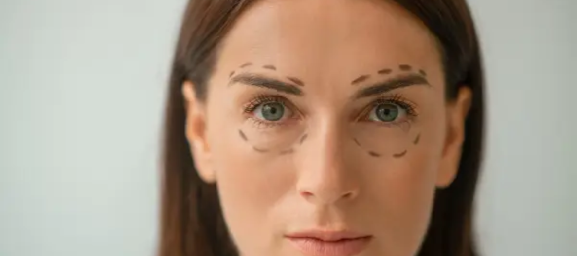 Levantamiento de cejas: rejuvenece tu mirada sin cirugía invasiva